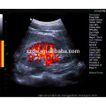 4D Farb-Doppler-Ultraschall-Maschine für die Schwangerschaft &amp; 4D Echokardiographie &amp; Ecografo Echo Maschine für Herz und Gefäß